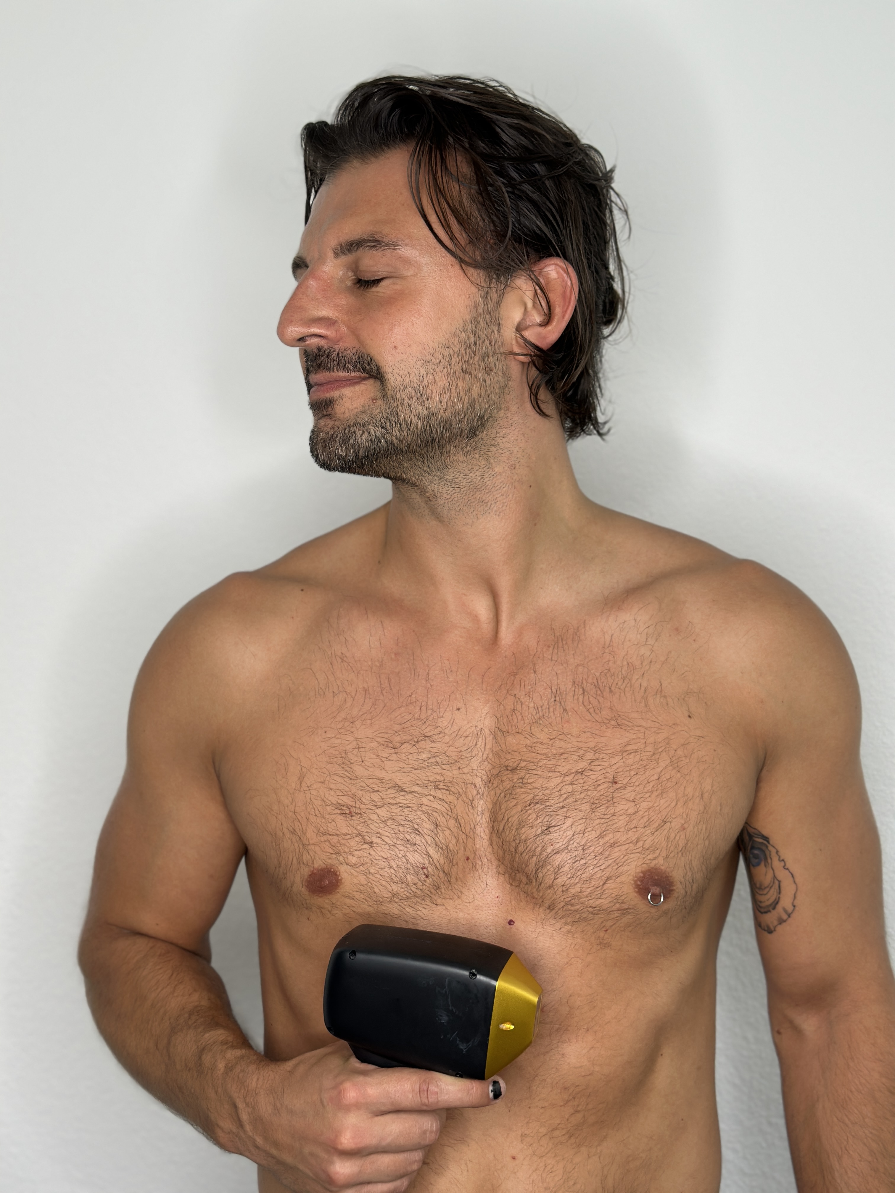 Laser-Haarentfernung 4